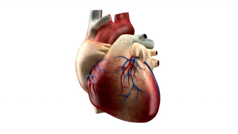 Dressler's Syndrome - UCLA-Olive View Internal Medicine