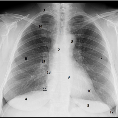 identify 8 - UCLA-Olive View Internal Medicine